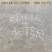 Neil Young - Before and After (LP) 